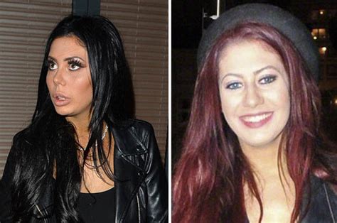 chloe ferry plastic surgery.